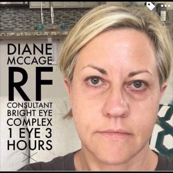 rf bright eye complex